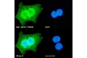 (ABIN184949) Immunofluorescence analysis of paraformaldehyde fixed A431 cells, permeabilized with 0.