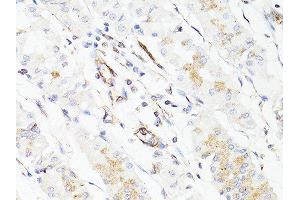 Immunohistochemistry of paraffin-embedded human stomach using VIM antibody.