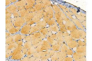 ABIN6257931 and ABIN6274147 at 1/100 staining Rat skin tissue by IHC-P. (ALDOA anticorps  (N-Term))