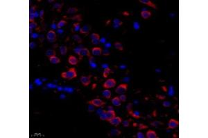 Immunofluorescence of paraffin embedded rat brain using PTPN12 (ABIN7075292) at dilution of 1: 1000 (400x lens)