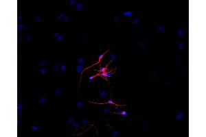 Immunofluorescence staining of P-19 mouse embryonal carcinoma cell line stimulated to neuronal differentiation by retinoic acid.