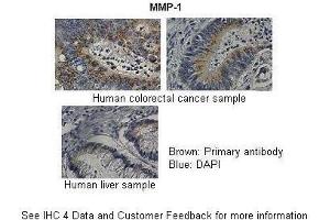 Human Colorectal cancer sample Human Liver Sample