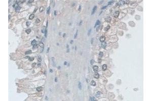 Detection of MHCB in Human Prostate Tissue using Polyclonal Antibody to Major Histocompatibility Complex Class I B (MHCB)