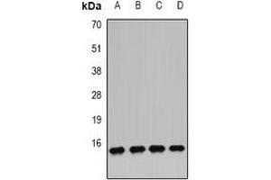 Western blot analysis of IFI6 expression in MCF7 (A), U251 (B), U937 (C), mouse pancreas (D) whole cell lysates. (IFI6 anticorps)