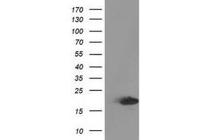 Western Blotting (WB) image for anti-Destrin (Actin Depolymerizing Factor) (DSTN) antibody (ABIN1497909) (Destrin anticorps)