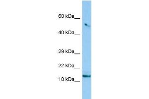 WB Suggested Anti-C8orf4 Antibody Titration: 1. (C8orf4 anticorps  (N-Term))