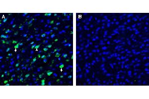 Expression of SLC38A9 in mouse cingulate cortex.