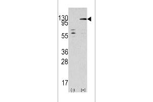 Western blot analysis of TAOK3 using rabbit polyclonal TAOK3 Antibody using 293 cell lysates (2 ug/lane) either nontransfected (Lane 1) or transiently transfected with the TAOK3 gene (Lane 2). (TAO Kinase 3 anticorps  (C-Term))