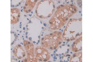 IHC-P analysis of kidney tissue, with DAB staining. (ABCA9 anticorps  (AA 1423-1590))