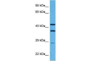 Host:  Rabbit  Target Name:  TREM2  Sample Tissue:  Human Jurkat Whole Cell  Antibody Dilution:  1ug/ml (TREM2 anticorps  (Middle Region))
