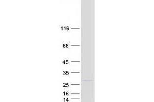 Validation with Western Blot