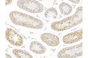ABIN7094799 and ABIN7098850 at 1/100 staining Mouse testis tissue by IHC-P.