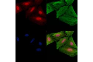 ABIN6257881 and ABIN6275326 staining  cells by IF/ICC. (NUSAP1 anticorps  (C-Term))