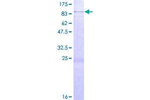 Image no. 1 for Usher Syndrome 1C (Autosomal Recessive, Severe) (USH1C) (AA 1-533) protein (GST tag) (ABIN1324733)