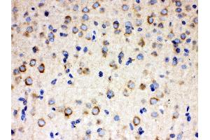 Anti- ULK3 Picoband antibody, IHC(P) IHC(P): Rat Brain Tissue (ULK3 anticorps  (C-Term))