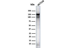 Western Blot Analysis of HCT116 cell lysate using MSH6 Mouse Monoclonal Antibody (MSH6/3089). (MSH6 anticorps  (AA 374-540))