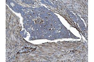 IHC analysis of EHD3 using anti-EHD3 antibody (ABIN7602777). (EHD3 anticorps  (C-Term))