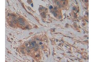 Used in DAB staining on fromalin fixed paraffin- embedded kidney tissue (PKM2 anticorps  (AA 141-248))