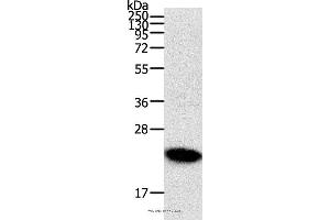 Western blot analysis of Human fetal brain tissue, using RHOC Polyclonal Antibody at dilution of 1:300 (RHOC anticorps)