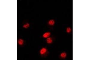 Immunofluorescent analysis of POLR3E staining in Hela cells. (POLR3E anticorps)