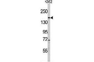 Western blot analysis of PHLPP1 polyclonal antibody  in K-562 cell line lysates (35 ug/lane). (PHLPP1 anticorps  (N-Term))