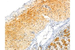 ABIN6260455 and ABIN6272989 at 1/100 staining Rat stomach tissue by IHC-P.