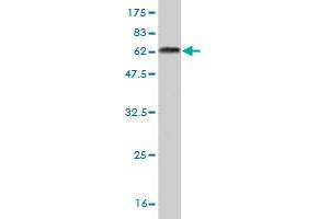 Western Blot detection against Immunogen (61. (NK2 Homeobox 5 anticorps  (AA 1-324))