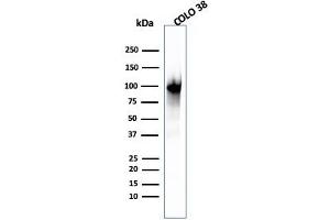 Western Blot Analysis of COLO-38 cell lysate using gp100 Mouse Monoclonal Antibody (PMEL/2039). (Melanoma gp100 anticorps  (AA 376-502))