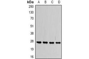 Western blot analysis of VAP-B/C expression in SW480 (A), HepG2 (B), Raji (C), mouse brain (D) whole cell lysates.
