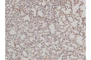 ABIN6267554 at 1/100 staining mouse lung tissue sections by IHC-P.