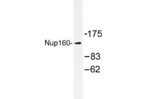 Image no. 1 for anti-Nucleoporin 160kDa (NUP160) antibody (ABIN317926) (NUP160 anticorps)