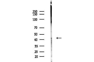 anti-Matrix Metallopeptidase 23B (MMP23B) (C-Term) antibody