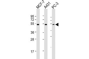 All lanes : Anti-P2R5E Antibody (C-term) at 1:2000 dilution Lane 1: MCF-7 whole cell lysates Lane 2: A431 whole cell lysates Lane 3: PC-3 whole cell lysates Lysates/proteins at 20 μg per lane.