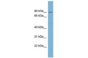 HECTD2 antibody used at 1 ug/ml to detect target protein.