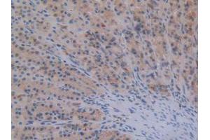 IHC-P analysis of Rat Stomach Tissue, with DAB staining. (STAT2 anticorps  (AA 587-838))