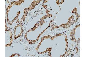 IHC analysis of LSM8 using anti-LSM8 antibody (ABIN7599578). (NAA38 anticorps  (AA 1-96))