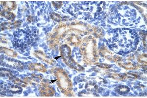 Rabbit Anti-OR13C9 Antibody Catalog Number: ARP31898 Paraffin Embedded Tissue: Human Kidney Cellular Data: Epithelial cells of renal tubule Antibody Concentration: 4. (OR13C9 anticorps  (Middle Region))