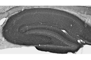 Adult rat hippocampus immunohistochemistry under standard protocol. (LGI1 anticorps  (AA 37-113))