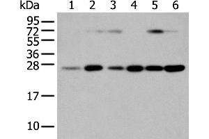 Western Blotting (WB) image for anti-Synaptosomal-Associated Protein, 23kDa (SNAP23) antibody (ABIN2424185) (SNAP23 anticorps)