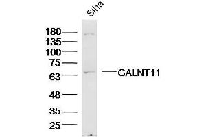 Siha Cell lysates probed with GALNT11/GalNAc-T11 Polyclonal Antibody, unconjugated  at 1:300 overnight at 4°C followed by a conjugated secondary antibody for 60 minutes at 37°C. (GALNT11 anticorps  (AA 401-500))