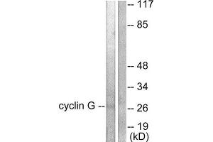 Western Blotting (WB) image for anti-Cyclin G1 (CCNG1) (Internal Region) antibody (ABIN1848500) (Cyclin G1 anticorps  (Internal Region))