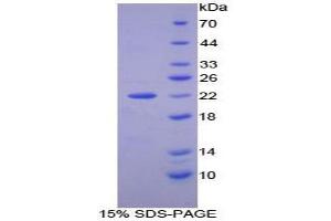 SDS-PAGE analysis of Human Nucleoredoxin Protein.