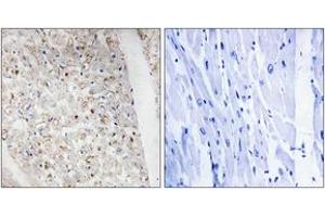 Immunohistochemistry analysis of paraffin-embedded human heart, using PKD1/2/3/PKC mu (Phospho-Ser738+Ser742) Antibody. (PKD1/2/3/PKC mu (AA 706-755), (pSer738) anticorps)