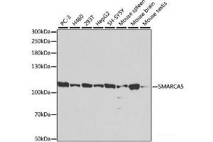 Western blot analysis of extracts of various cell lines using SMARCA5 Polyclonal Antibody at dilution of 1:1000. (SMARCA5 anticorps)