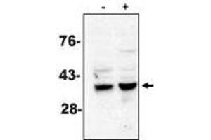 Western blot analysis using caspase-7 antibody on MCF-7 cells treated with thapsigargin for 48 hours which are negative (-) and positive (+) for caspase-3. (Caspase 7 anticorps)