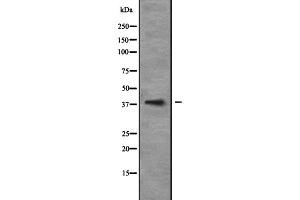 Western blot analysis of NEUROD6 expression in 293T whole cell lysate ,The lane on the left is treated with the antigen-specific peptide. (NEUROD6 anticorps  (Internal Region))