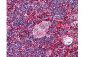 Anti-ARPC1B / p41-ARC antibody IHC of human thymus. (ARPC1B anticorps  (AA 2-14))