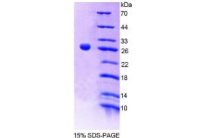 SDS-PAGE analysis of Human NOX1 Protein. (NOX1 Protéine)
