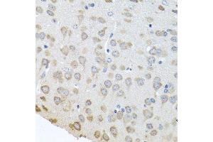 Immunohistochemistry of paraffin-embedded mouse brain using PABPC4 antibody.