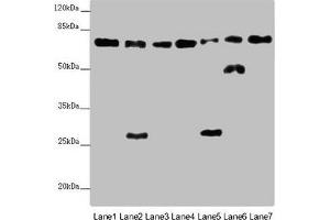 Western blot All lanes: ALB antibody at 2 μg/mL Lane 1: Mouse heart tissue Lane 2: Mouse liver tissue Lane 3: Mouse spleen tissue Lane 4: Mouse lung tissue Lane 5: Mouse kidney tissue Lane 6: Mouse brain tissue Lane 7: Mouse skeletal muscle tissue Secondary Goat polyclonal to rabbit IgG at 1/10000 dilution Predicted band size: 70, 48, 46 kDa Observed band size: 70, 50, 27 kDa (Albumin anticorps  (AA 76-389))